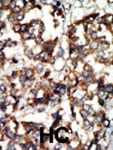 IHC-P - ATM Antibody (N-term) AP8046a
